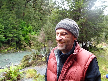 Tramping Injuries
Photographer;&nbsp;Alan
2019-01-21&nbsp;11.26.55;&nbsp;Metadata time: '2019 Jan 21 11:26'
Original size:&nbsp;5,152 x 3,864; 7,968 kB
Filename: 2019-01-21 11.26.55 DSC02623 Alan - tramping injuries.jpeg